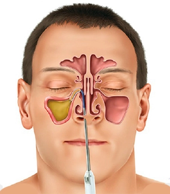 Geniz Akıntısı nasıl geçer